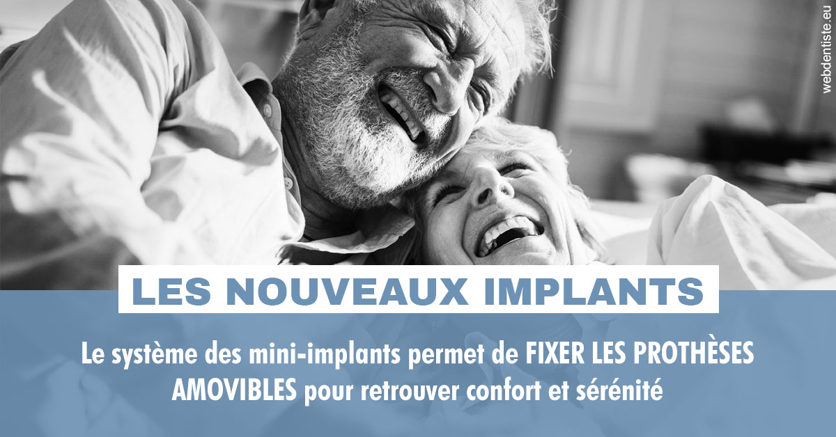 https://www.dentiste-de-chaumont.fr/Les nouveaux implants 2