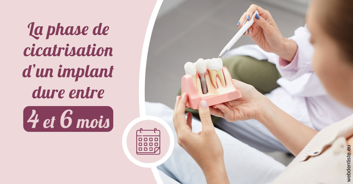 https://www.dentiste-de-chaumont.fr/Cicatrisation implant 2