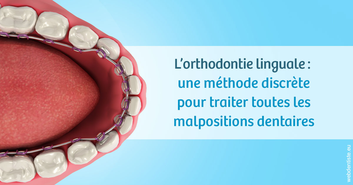 https://www.dentiste-de-chaumont.fr/L'orthodontie linguale 1