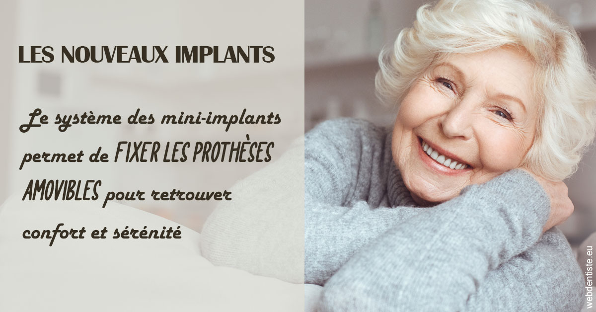 https://www.dentiste-de-chaumont.fr/Les nouveaux implants 1