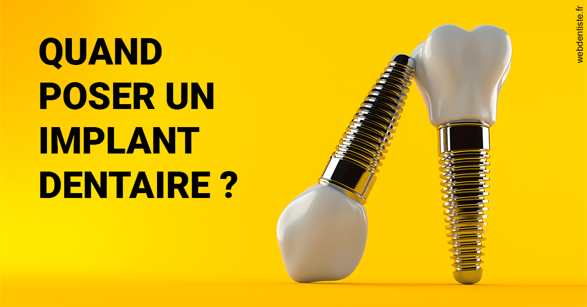 https://www.dentiste-de-chaumont.fr/Les implants 2
