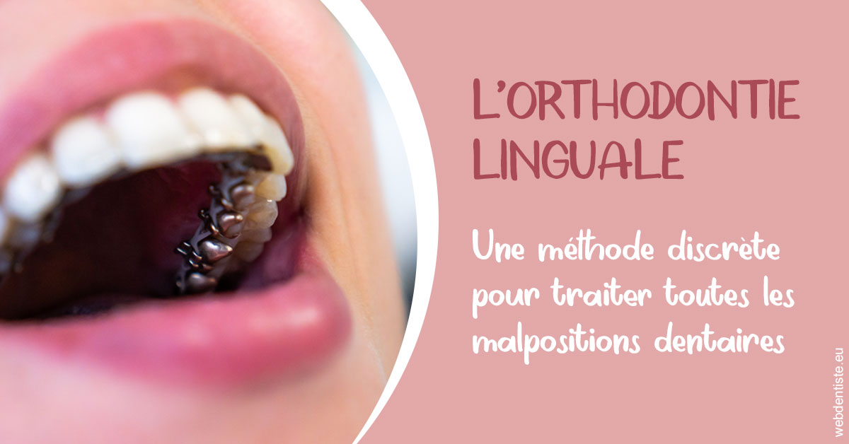 https://www.dentiste-de-chaumont.fr/L'orthodontie linguale 2