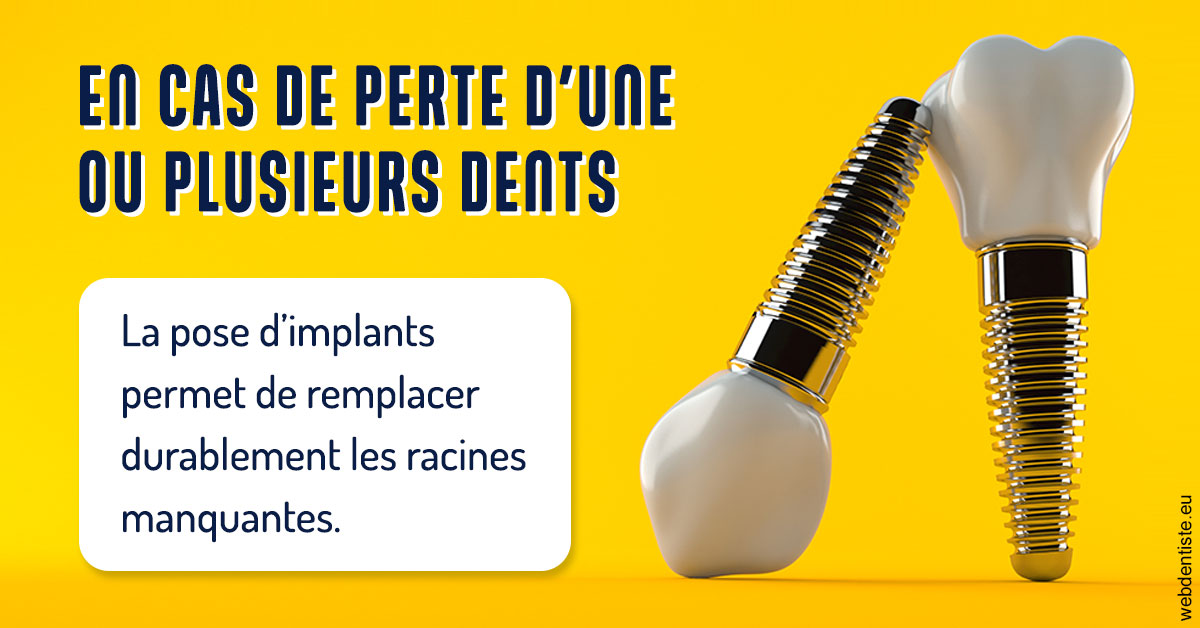https://www.dentiste-de-chaumont.fr/2024 T1 - Implants 02