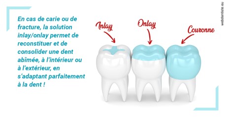 https://www.dentiste-de-chaumont.fr/L'INLAY ou l'ONLAY