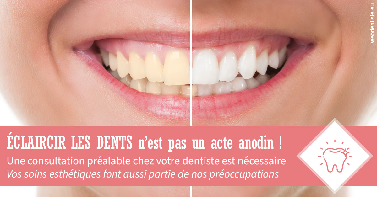 https://www.dentiste-de-chaumont.fr/Eclaircir les dents 1