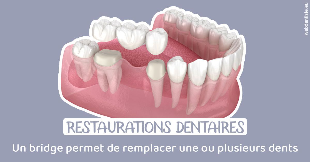 https://www.dentiste-de-chaumont.fr/Bridge remplacer dents 1