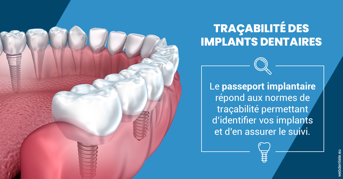 https://www.dentiste-de-chaumont.fr/T2 2023 - Traçabilité des implants 1
