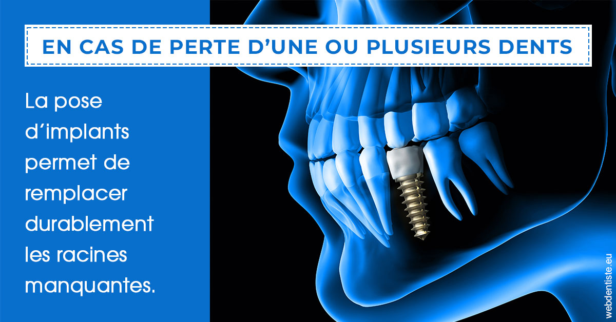 https://www.dentiste-de-chaumont.fr/2024 T1 - Implants 01