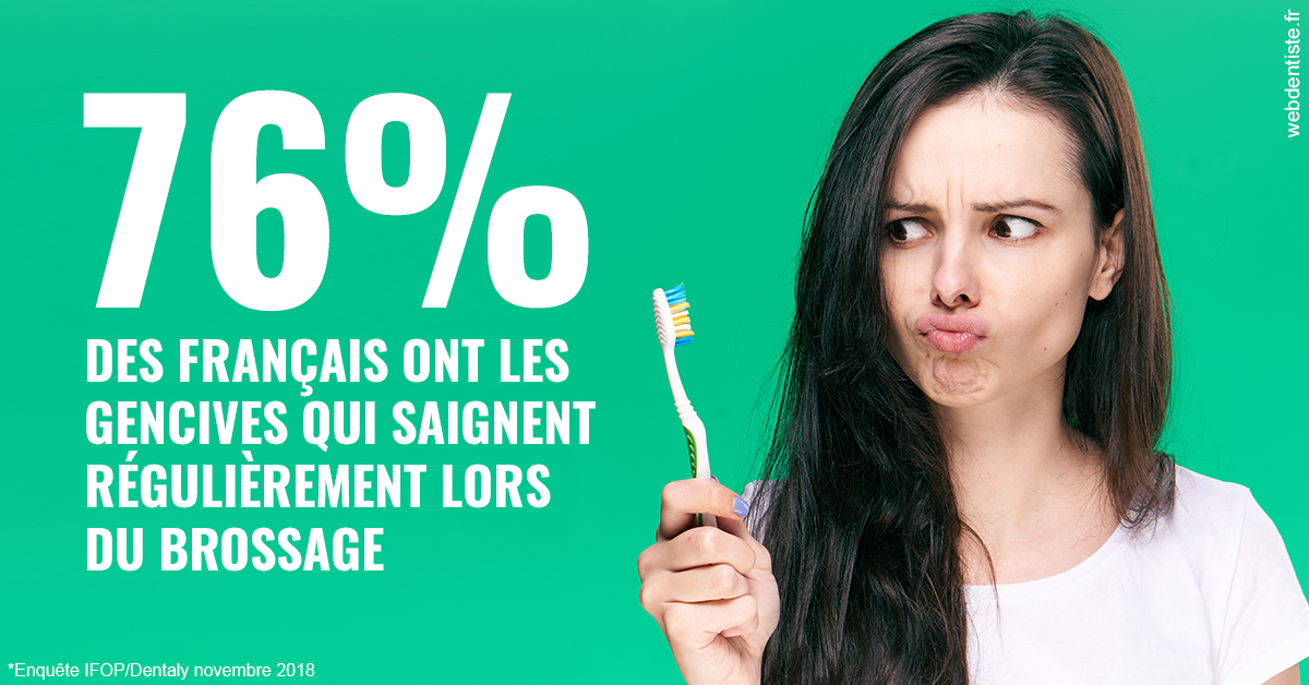 https://www.dentiste-de-chaumont.fr/76% des Français 1
