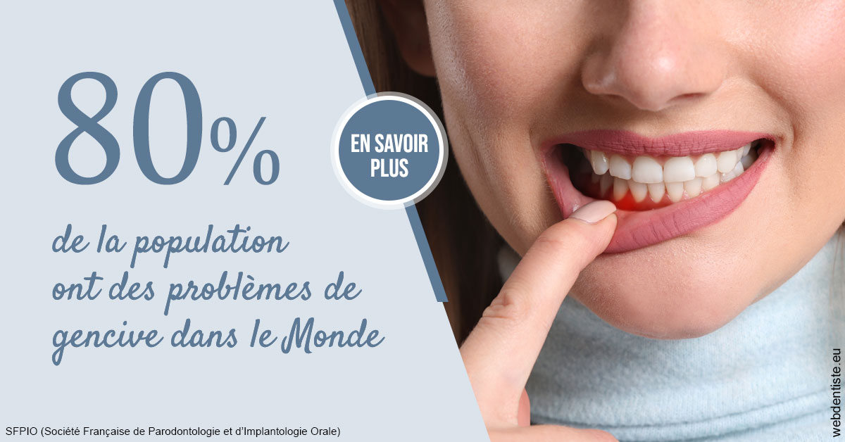 https://www.dentiste-de-chaumont.fr/Problèmes de gencive 2