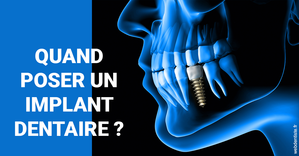 https://www.dentiste-de-chaumont.fr/Les implants 1