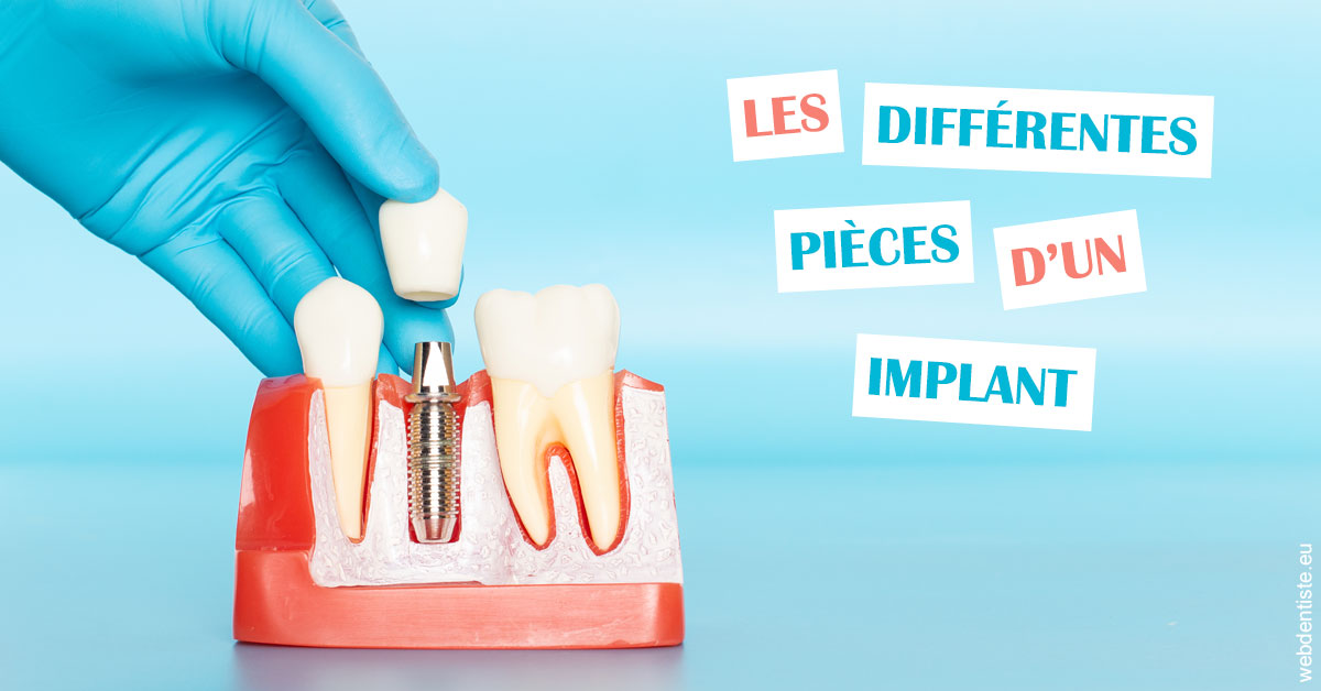 https://www.dentiste-de-chaumont.fr/Les différentes pièces d’un implant 2
