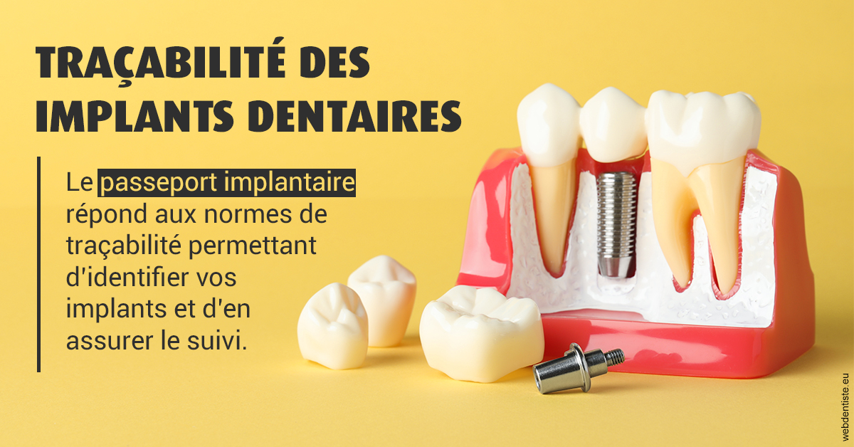 https://www.dentiste-de-chaumont.fr/T2 2023 - Traçabilité des implants 2