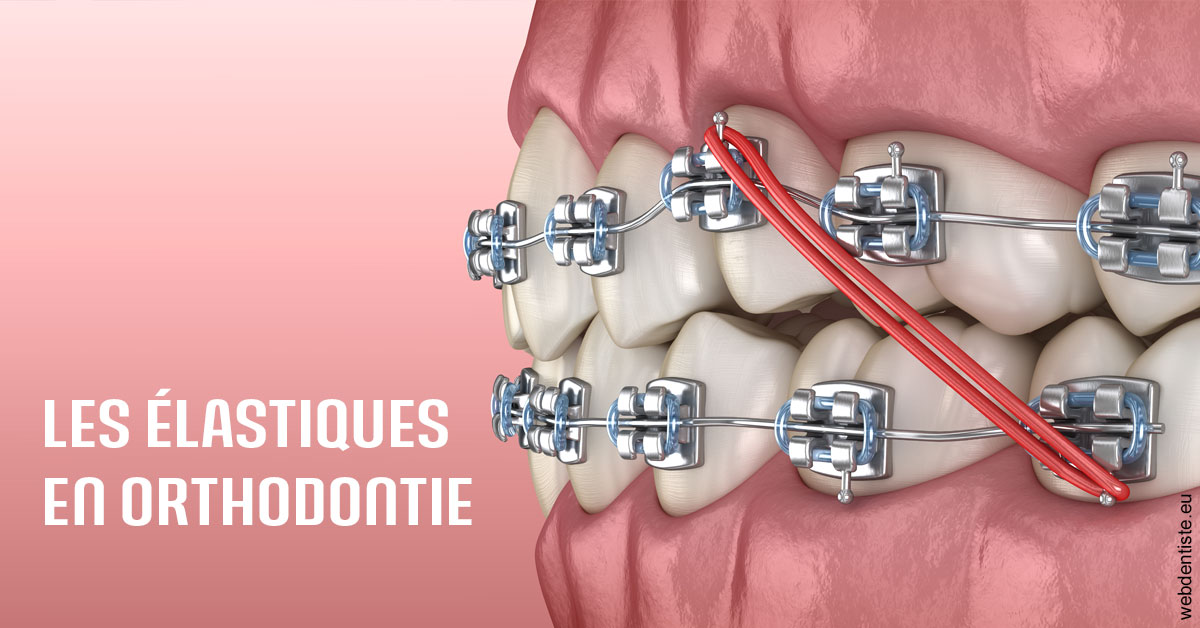 https://www.dentiste-de-chaumont.fr/Elastiques orthodontie 2