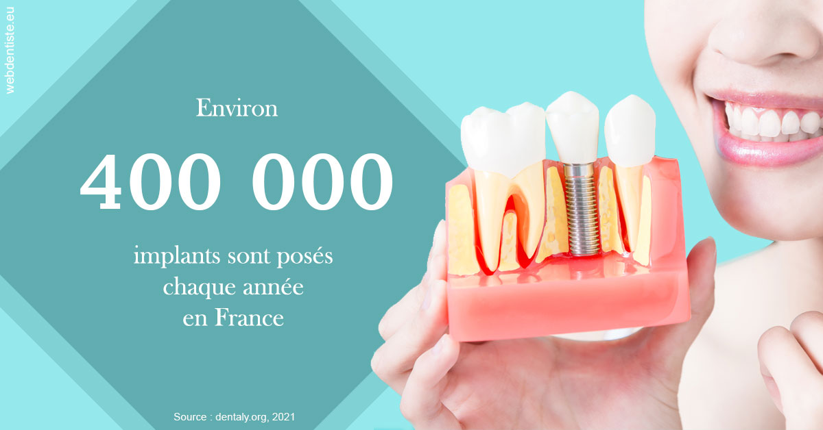 https://www.dentiste-de-chaumont.fr/Pose d'implants en France 2