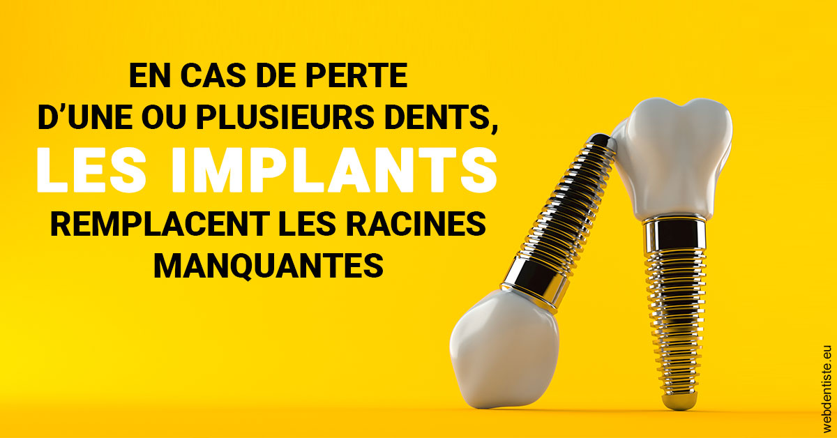 https://www.dentiste-de-chaumont.fr/Les implants 2