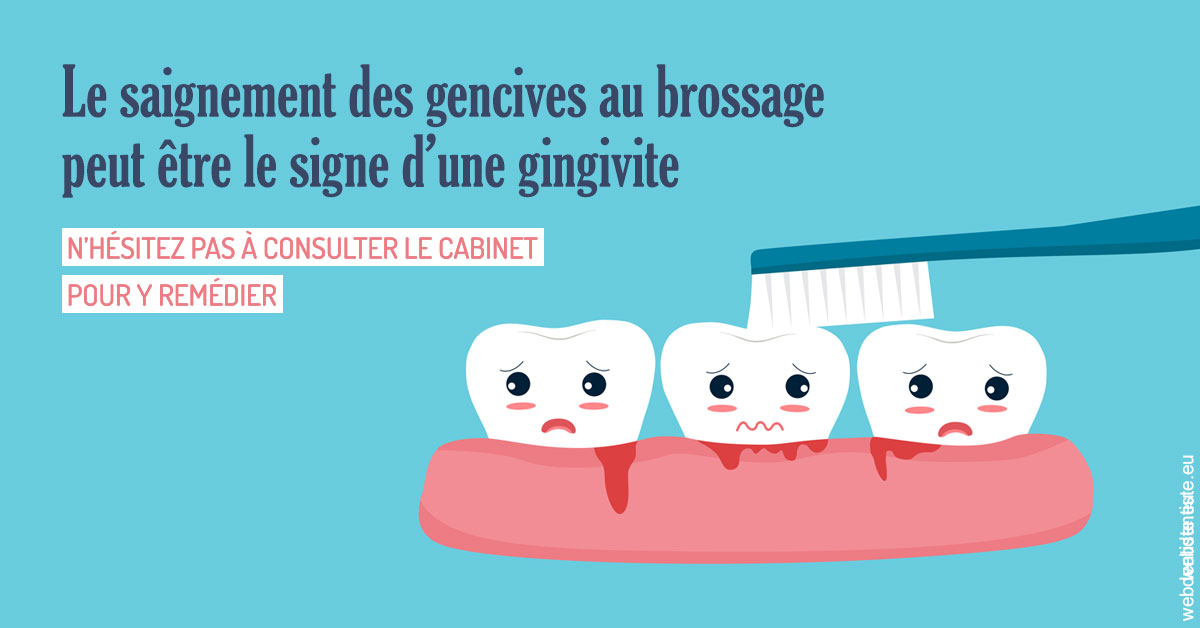 https://www.dentiste-de-chaumont.fr/2023 T4 - Saignement des gencives 02